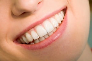 So sánh tẩy trắng răng và bọc sứ răng