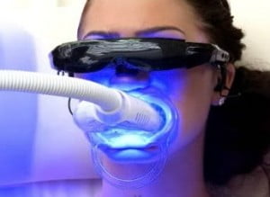 Tẩy trắng răng bằng Laser có an toàn không