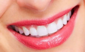 Những tác dụng của phương pháp niềng răng