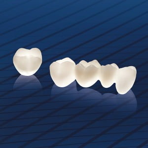 Các yếu tố liên quan đến răng sứ Cercon ht