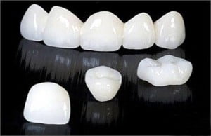 Các yếu tố liên quan đến răng sứ Cercon ht 