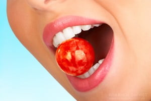 Không nên ăn gì khi niềng răng ?