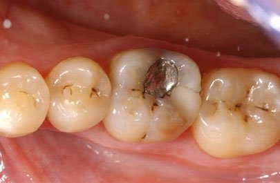 Điều trị răng miệng tại trung tâm nha khoa
