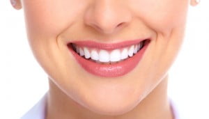 Niềng răng thẩm mỹ để sở hữu hàm răng đẹp 