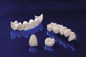 Tổng hợp những lợi ích của dịch vụ bọc răng sứ