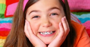 Phương pháp niềng răng cho trẻ em như thế nào ?