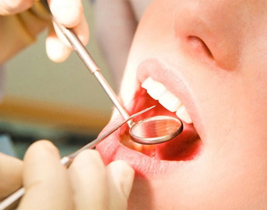 Thẩm mỹ hàm răng tại nha khoa