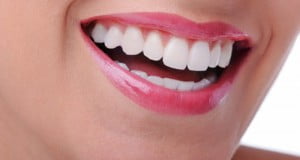 Thời gian tẩy trắng răng nhanh nhất là bao lâu?