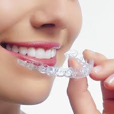 Loại bổ răng ú vàng bằng phương pháp tẩy trắng