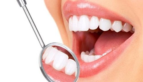 Tìm hiểu thông tin về niềng răng mắc cài 3m ugsl 3