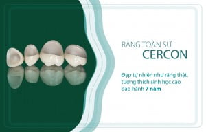 Quy trình bọc răng sứ như thế nào ?