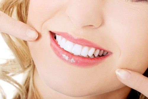 Bọc răng sứ Veneer có hiệu quả không? 2