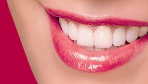 Quy trình bọc răng sứ titan như thế nào ?