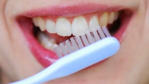 Tác dụng của niềng răng