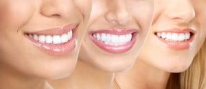 Tẩy trắng răng có an toàn không ?
