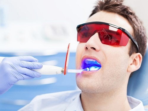 Tẩy trắng răng có an toàn không? 2