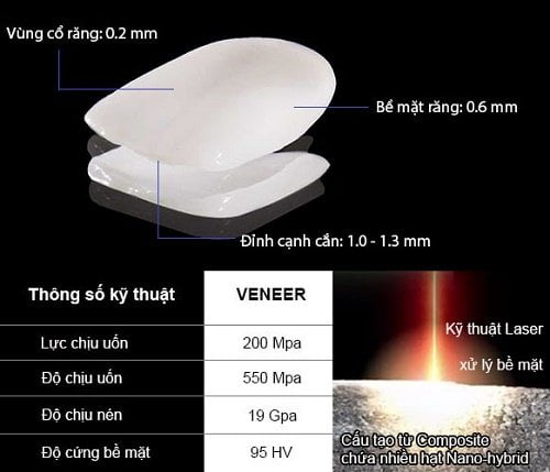 Mặt dán Veneer sứ - Phục hình thẩm mỹ răng thật 2