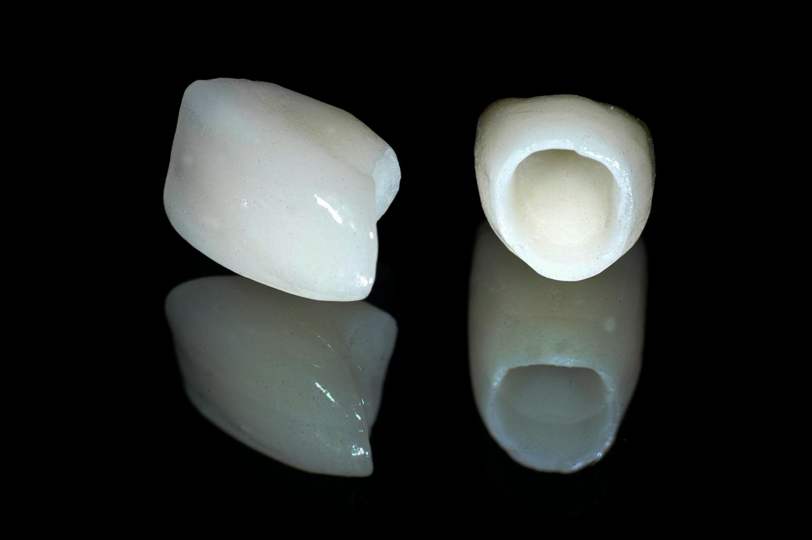 Ưu điểm của răng sứ E.Max
