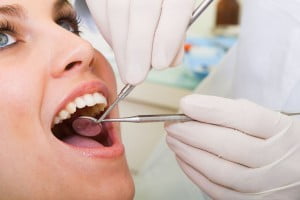 Phục hình răng Implant 4S giá bao nhiêu ?
