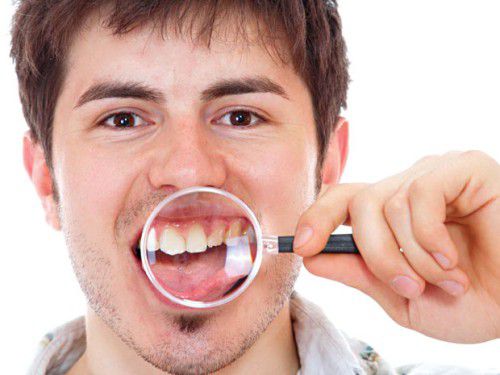 Chăm sóc sau khi nhổ răng khôn