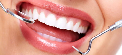 Ưu điểm của răng sứ Zirconia là gì ?