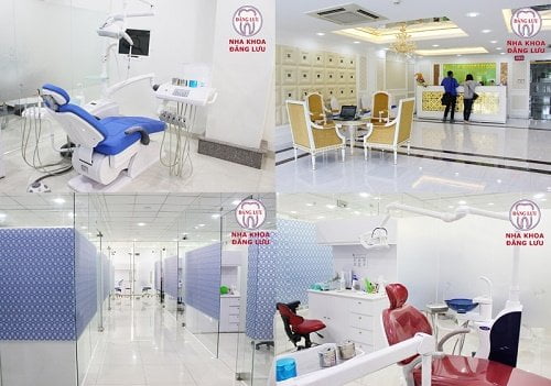 Kinh nghiệm làm răng implant cho bạn hiệu quả 3