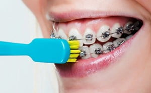 phẫu thuật nâng chân mày có đau không
