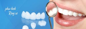 Cách bọc răng sứ an toàn hiệu quả