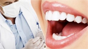 Cách bọc răng sứ an toàn hiệu quả