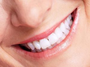 cạo vôi răng có tác dụng gì