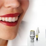 Địa chỉ trồng răng implant tốt nhất ở đâu?