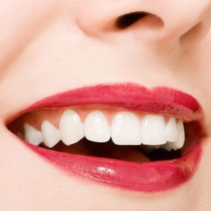 Độ bền của răng sứ thẩm mỹ có cao không?