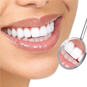 Làm răng sứ có phải lấy tủy không?