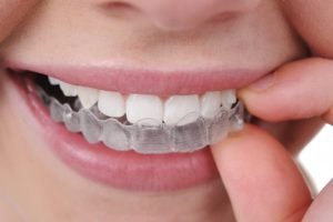 những cách làm trắng răng tại nha khoa hiện nay