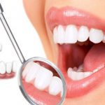 Trồng răng hàm giá bao nhiêu tiền?