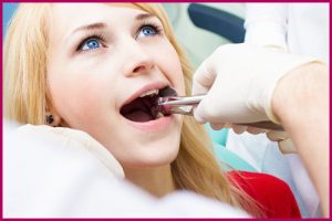 Nhổ răng khôn có ảnh hưởng gì không?