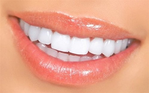 Trồng răng kiêng ăn gì? Tư vấn thực tế tại nha khoa 1