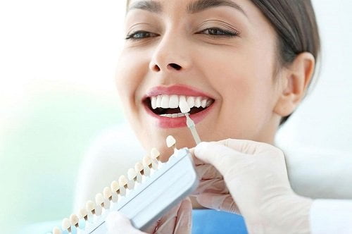 Bọc răng sứ không cần mài răng - Quy trình thực hiện 1