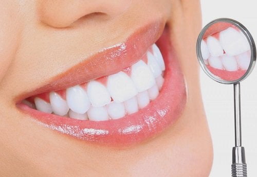 Bọc răng sứ không cần mài răng - Quy trình thực hiện 3