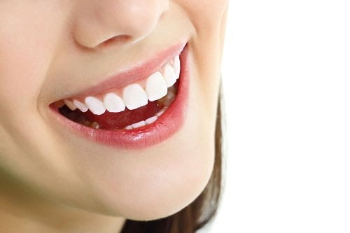 Bọc răng sứ titan có tốt không? Tìm hiểu răng sứ titan 3