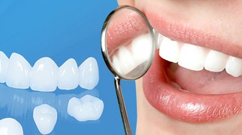 Bọc răng sứ có nguy hiểm không? Lời giải đáp tốt nhất cho bạn 2