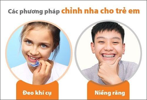 Niềng răng trẻ em bao nhiêu tiền? Có rẻ như lời quảng cáo không? 3