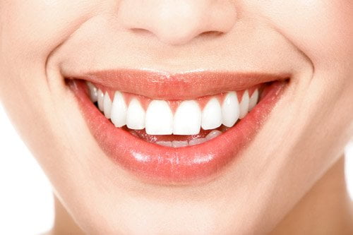 Phương pháp chữa răng hô không cần niềng đơn giản 3