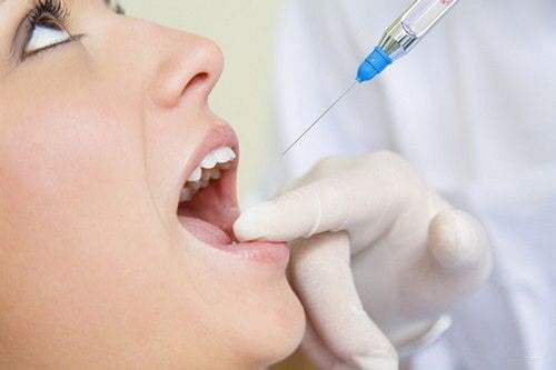 Trồng răng giả có đau không? Những thông tin cần biết 4