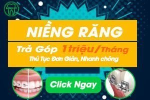 niềng răng trả góp