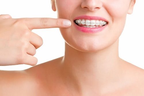 Niềng răng bị hóp má phải xử lý ra sao? 2