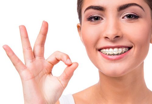 Niềng răng phải nhổ răng nào để đạt kết quả cao? 1