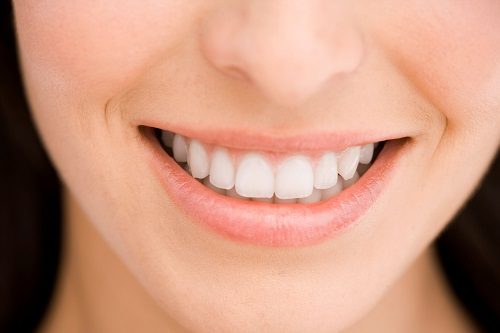 Bọc sứ răng cửa giá bao nhiêu? Tìm hiểu ngay 1