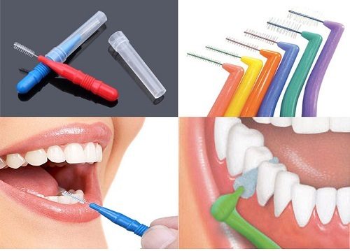 Niềng răng dùng bàn chải gì là hợp? 3