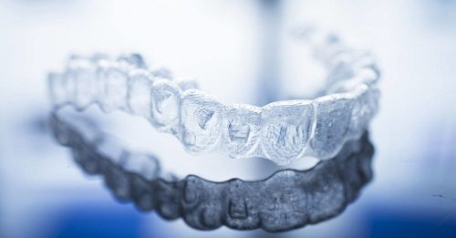 Niềng răng invisalign có nhổ răng không? 1